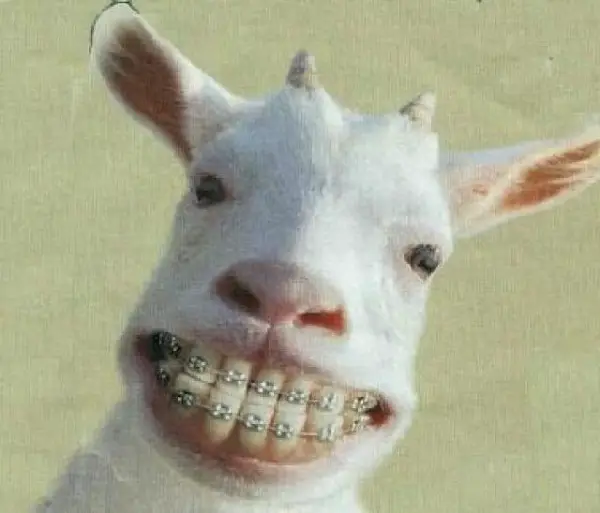 Imágenes graciosas con brackets