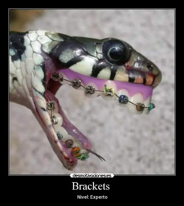 Imágenes graciosas con brackets